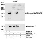 Phospho-SMC1 (Ser957) Antibody in Immunoprecipitation (IP)