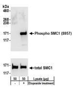 Phospho-SMC1 (Ser957) Antibody in Western Blot (WB)