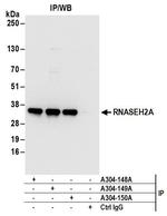 RNASEH2A Antibody in Immunoprecipitation (IP)