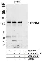 PPIP5K2 Antibody in Immunoprecipitation (IP)