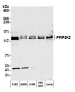 PPIP5K2 Antibody in Western Blot (WB)