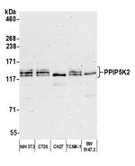 PPIP5K2 Antibody in Western Blot (WB)