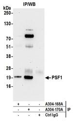 PSF1 Antibody in Immunoprecipitation (IP)