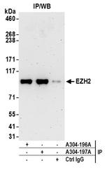 EZH2 Antibody in Immunoprecipitation (IP)