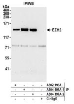 EZH2 Antibody in Immunoprecipitation (IP)