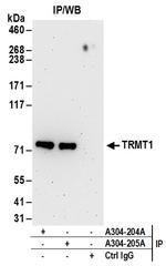 TRMT1 Antibody in Immunoprecipitation (IP)