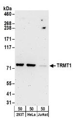 TRMT1 Antibody in Western Blot (WB)