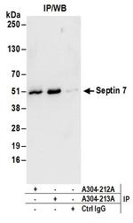 Septin 7 Antibody in Immunoprecipitation (IP)