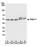 Septin 7 Antibody in Western Blot (WB)