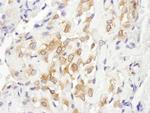 Septin 7 Antibody in Immunohistochemistry (Paraffin) (IHC (P))