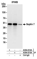 Septin 7 Antibody in Immunoprecipitation (IP)