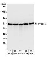 Septin 7 Antibody in Western Blot (WB)