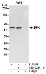 ZIPK Antibody in Immunoprecipitation (IP)