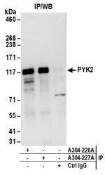 PYK2 Antibody in Immunoprecipitation (IP)