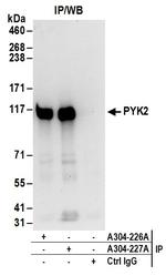 PYK2 Antibody in Immunoprecipitation (IP)