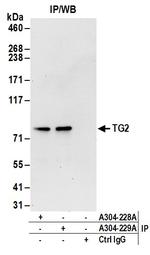 TG2 Antibody in Immunoprecipitation (IP)