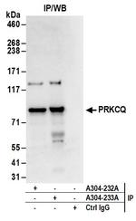 PRKCQ Antibody in Immunoprecipitation (IP)