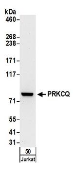 PRKCQ Antibody in Western Blot (WB)