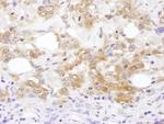 MKK7 Antibody in Immunohistochemistry (Paraffin) (IHC (P))