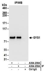 GYS1 Antibody in Immunoprecipitation (IP)