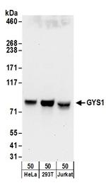 GYS1 Antibody in Western Blot (WB)