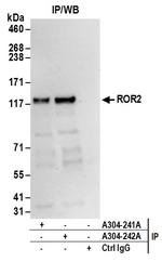 ROR2 Antibody in Immunoprecipitation (IP)