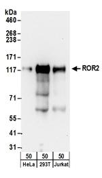 ROR2 Antibody in Western Blot (WB)