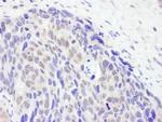 TET2 Antibody in Immunohistochemistry (Paraffin) (IHC (P))