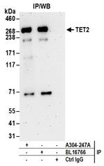 TET2 Antibody in Immunoprecipitation (IP)