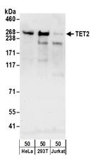 TET2 Antibody in Western Blot (WB)