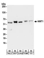 NMT1 Antibody in Western Blot (WB)