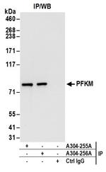 PFKM Antibody in Immunoprecipitation (IP)