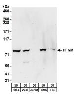 PFKM Antibody in Western Blot (WB)