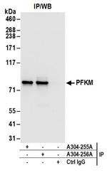 PFKM Antibody in Immunoprecipitation (IP)