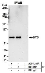 HCS Antibody in Immunoprecipitation (IP)