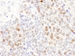 DCK Antibody in Immunohistochemistry (Paraffin) (IHC (P))