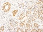 FNTA Antibody in Immunohistochemistry (Paraffin) (IHC (P))