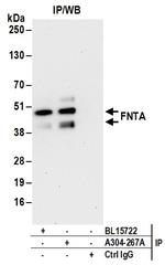 FNTA Antibody in Immunoprecipitation (IP)