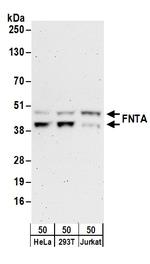 FNTA Antibody in Western Blot (WB)