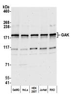 GAK Antibody in Western Blot (WB)