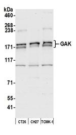 GAK Antibody in Western Blot (WB)