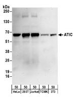 ATIC Antibody in Western Blot (WB)