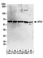 ATIC Antibody in Western Blot (WB)