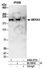 MEKK4 Antibody in Immunoprecipitation (IP)