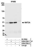 MAT2A Antibody in Immunoprecipitation (IP)