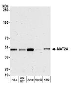 MAT2A Antibody in Western Blot (WB)