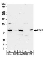 PFKP Antibody in Western Blot (WB)