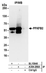 PFKFB2 Antibody in Immunoprecipitation (IP)