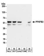 PFKFB2 Antibody in Western Blot (WB)