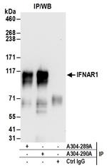 IFNAR1 Antibody in Immunoprecipitation (IP)